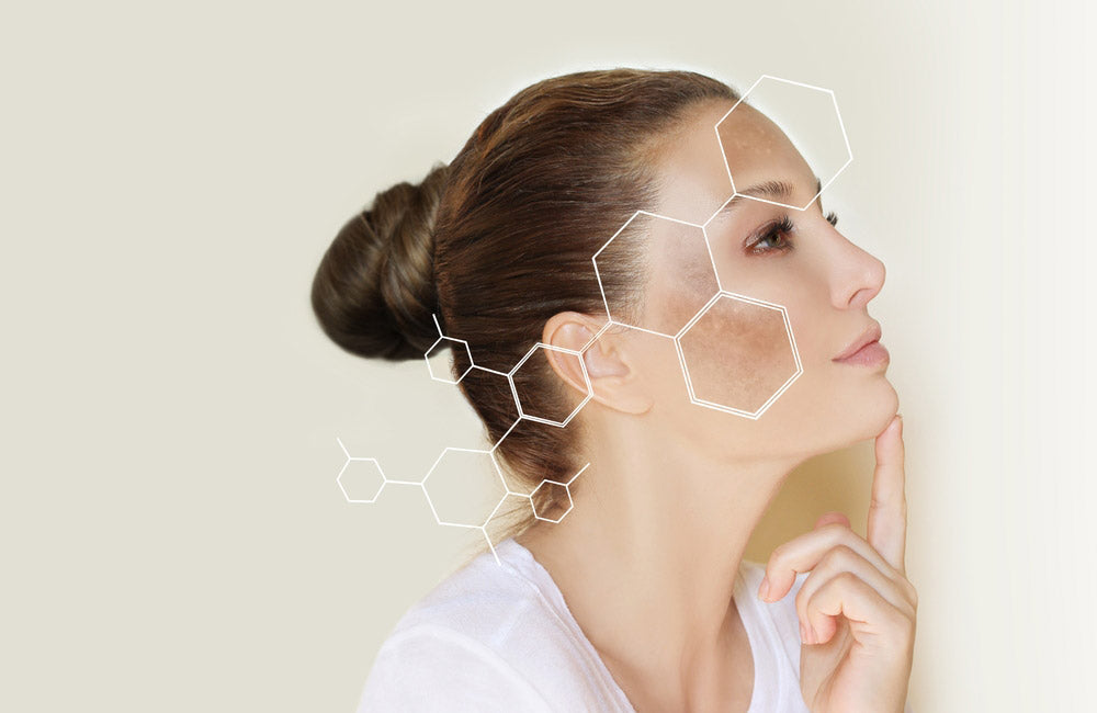 Hiperpigmentarea pielii: cauze, tratamente și sfaturi de prevenire - Viorica Cosmetic MD