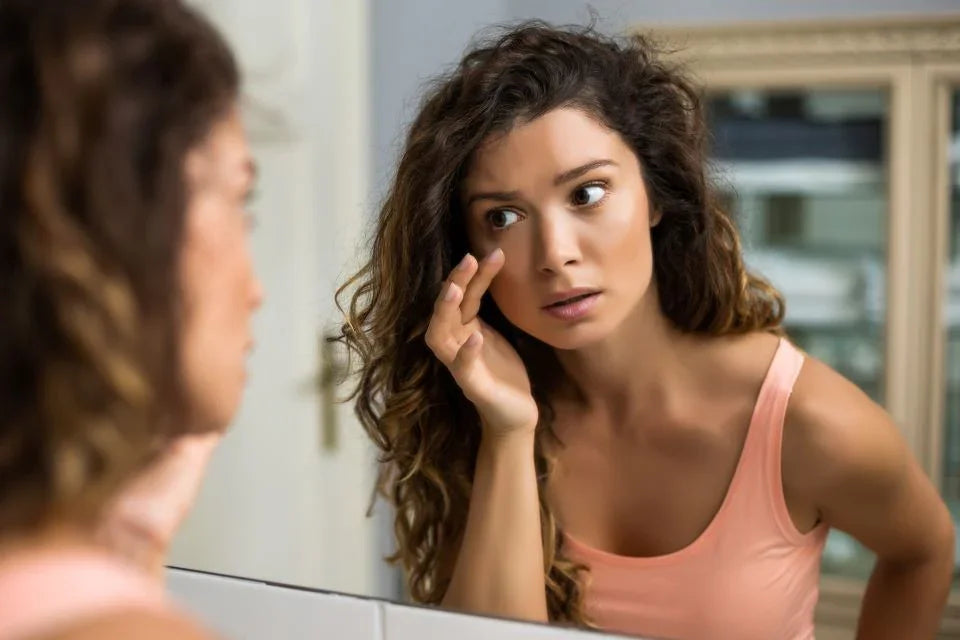 Pungi sub ochi: de ce apar și cum poți să le previi? - Viorica Cosmetic MD
