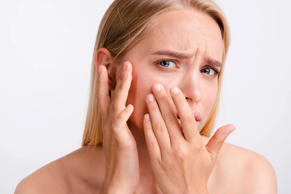 Purgingul, ce este și când apare? - Viorica Cosmetic MD