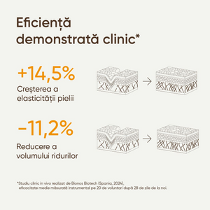 Crema 21Collagen SPF 25: eficienta demonstrata clinic, +14,5% elasticitate, -11,2% volumul ridurilor