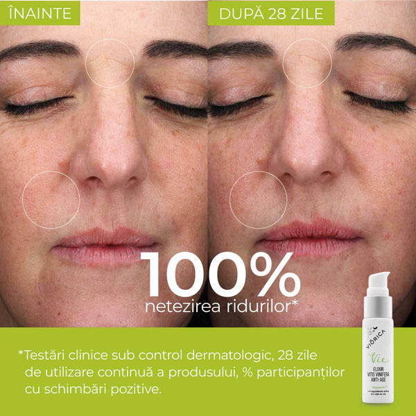 Rezultate utilizare ser „Elixir Vitis Vinifera Anti-Age”, piele înainte și după 28 zile, efect netezire riduri.